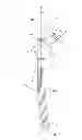 Fig. 03 - Femoral prosthesis with insertion/extraction feature