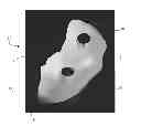 Fig. 01 - Orthopaedic implants