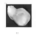 Fig. 04 - Orthopaedic implants