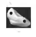 Fig. 08 - Orthopaedic implants
