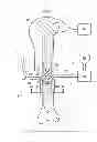 Fig. 02 - Systems for inducing fluid flow to stimulate tissue growth