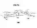 Fig. 86 - Physical activity feedback systems and methods