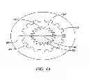 Fig. 05 - Electric Hybrid Drive for Retrofitting to Internal Combustion Automobiles