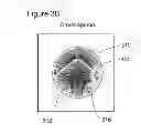 Fig. 06 - System and method for three-dimensional iterative filtering of scattered waves in cross spread seismic systems