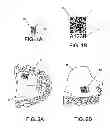Fig. 02 - RAPID IDENTIFICATION OF DENTAL PROSTHESES