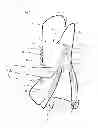 Fig. 02 - Hand Enclosure Garment