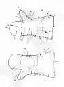 Fig. 03 - Hand Enclosure Garment