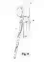 Fig. 09 - Device for cleaning and remotely inspecting a chimney