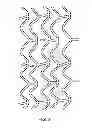 Fig. 03 - Method of uniform crimping and expansion of medical devices