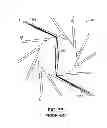 Fig. 11 - Method of uniform crimping and expansion of medical devices