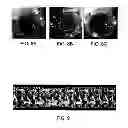Fig. 12 - Method of uniform crimping and expansion of medical devices