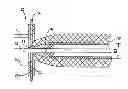 Fig. 01 - Device and method for field expansion