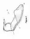 Fig. 02 - Miracle heel