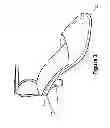 Fig. 03 - Miracle heel