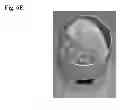 Fig. 10 - COMPOSITIONS AND METHODS FOR LEACH EXTRACTION OF MICROORGANISMS