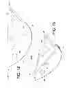 Fig. 10 - Stretching device