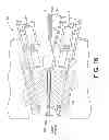 Fig. 13 - Stretching device