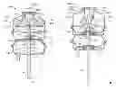 Fig. 01 - Deflection spring pneumatic actuator