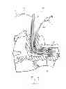 Fig. 09 - Reversible airway device and related method for ventilating a subject