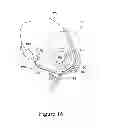 Fig. 17 - Supplemental gas delivery device for mask assembly