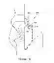 Fig. 20 - Supplemental gas delivery device for mask assembly