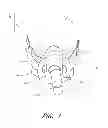 Fig. 02 - Interface comprising a rolling nasal bridge portion
