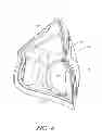 Fig. 06 - Interface comprising a rolling nasal bridge portion