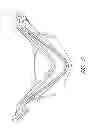 Fig. 09 - Interface comprising a rolling nasal bridge portion