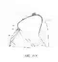 Fig. 13 - Interface comprising a rolling nasal bridge portion