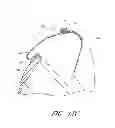 Fig. 15 - Interface comprising a rolling nasal bridge portion