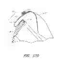 Fig. 16 - Interface comprising a rolling nasal bridge portion