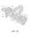 Fig. 26 - Interface comprising a rolling nasal bridge portion