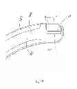 Fig. 33 - Interface comprising a rolling nasal bridge portion