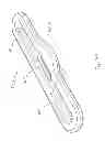 Fig. 43 - Interface comprising a rolling nasal bridge portion