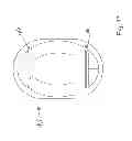 Fig. 50 - Interface comprising a rolling nasal bridge portion