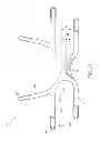 Fig. 57 - Interface comprising a rolling nasal bridge portion