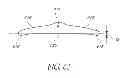 Fig. 65 - Interface comprising a rolling nasal bridge portion