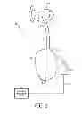 Fig. 02 - Patient interface device including an adjustable forehead support having a vertical wheel drive mechanism