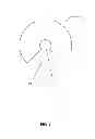 Fig. 03 - Prophylactic device and methods of use