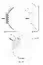 Fig. 16 - Prophylactic device and methods of use