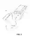 Fig. 03 - Sleeping Device to Prevent Snoring