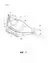 Fig. 02 - Mask