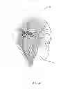 Fig. 06 - Hair Ties