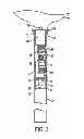 Fig. 04 - Balloon Inflation, Illumination and Holding Device
