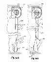 Fig. 43 - Retractable shade with collapsible vanes