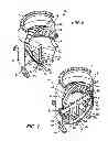 Fig. 05 - Debris filter with splitter bar