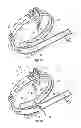 Fig. 10 - Toy vehicle track set