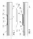 Fig. 02 - Bonding of substrates including metal-dielectric patterns with metal raised above dielectric and structures so formed