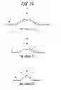 Fig. 11 - Metal gasket