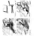 Fig. 03 - METHODS OF VEHICLE SUSPENSION